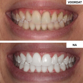 WellaWhite image