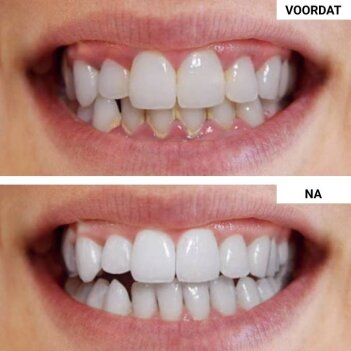 WellaWhite image