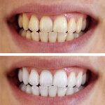 WellaWhite image