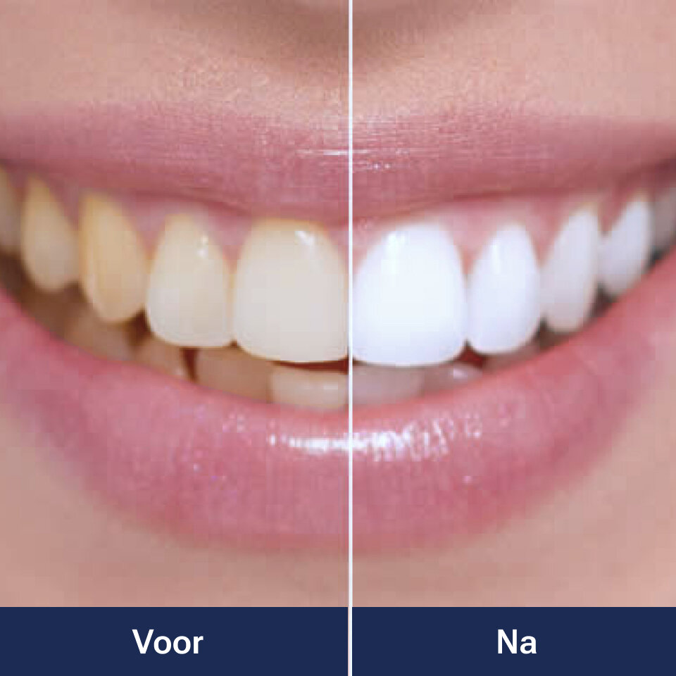 WellaWhite image